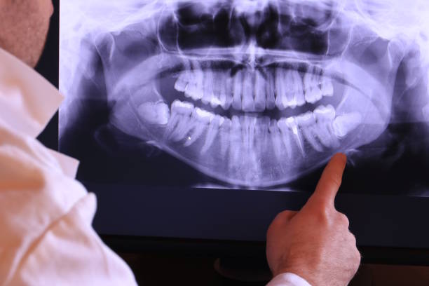 Best Walk-In Emergency Dental Services in Port Oconnor, TX